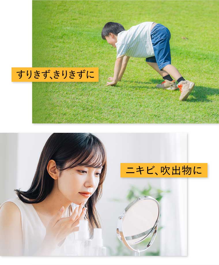 すりきず、きりきずに ニキビ、吹出物に