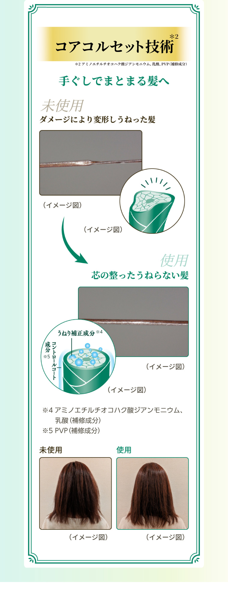 コアコルセット技術