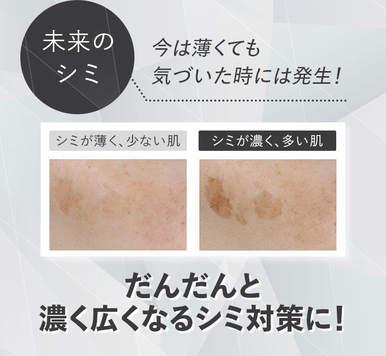 今は薄くても気づいた時には発生！未来のシミ だんだんと濃く広くなるシミ対策に！