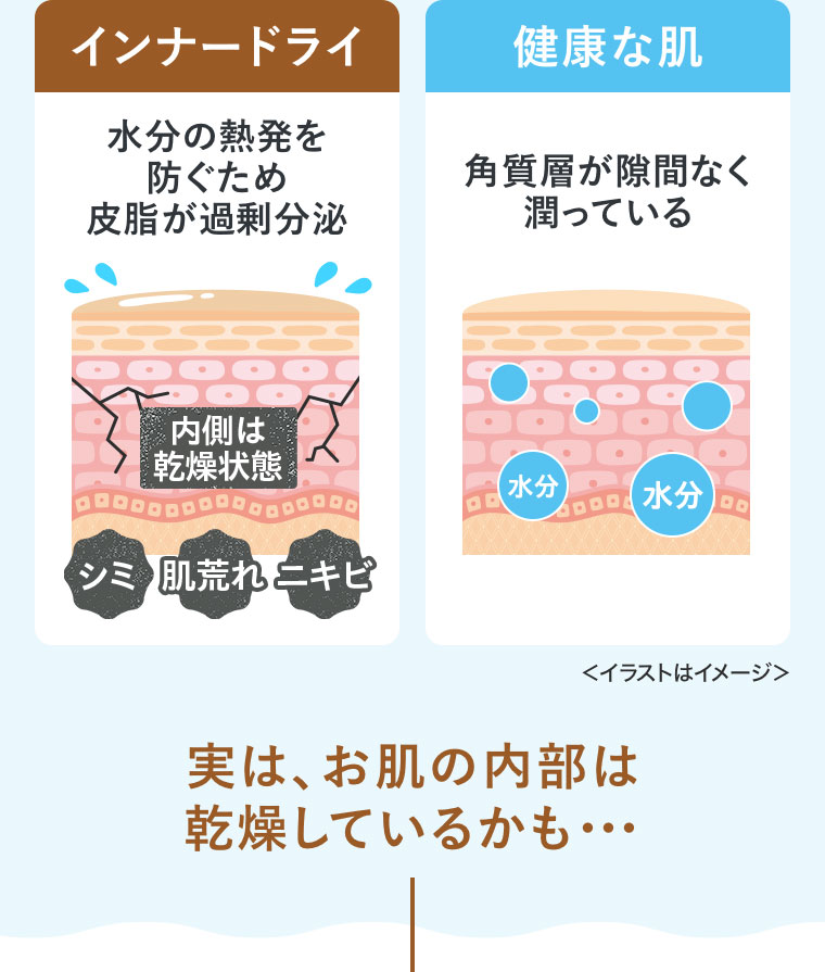 インナードライ。水分の熱発を防ぐため、皮脂が過剰分泌。健康な肌。角質層が隙間なく潤っている。イメージ（本画像をご確認ください）。実は、お肌の内部は乾燥しているかも…