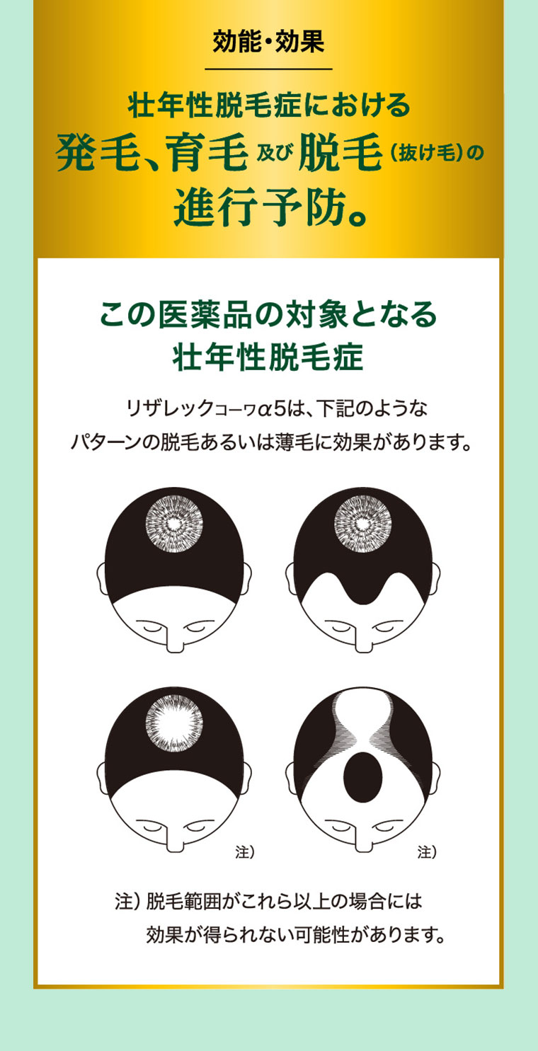 効能・効果。壮年性脱毛症における発毛、育毛及び脱毛(抜け毛)の進行予防。この医薬品の対象となる壮年性脱毛症。リザレックコーワα5は、下記のようなパターンの脱毛あるいは薄毛に効果があります。図(本画像をご確認ください)。