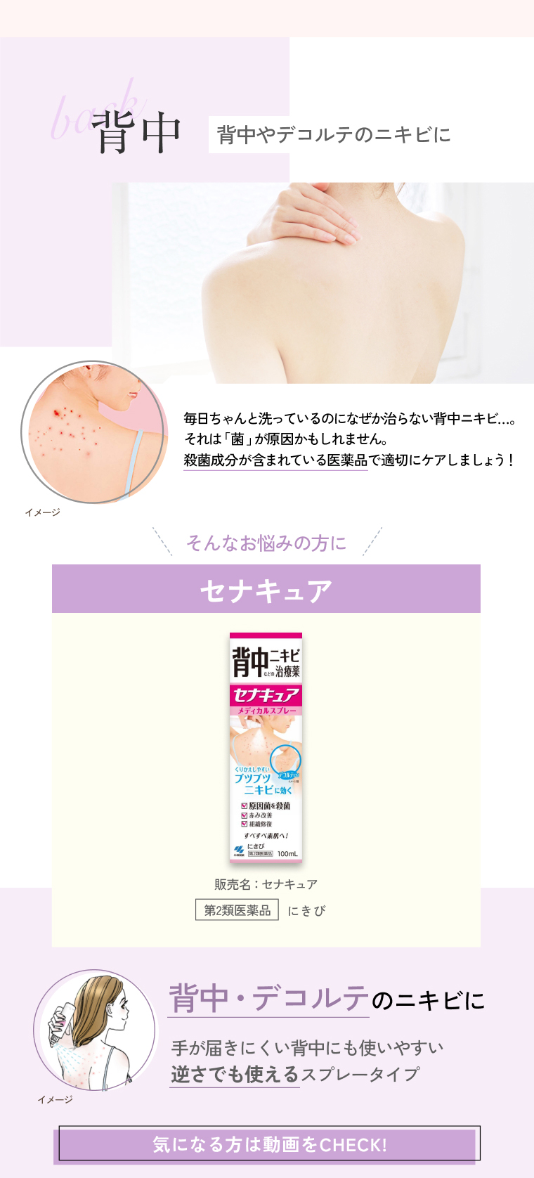 背中 背中やデコルテのニキビに