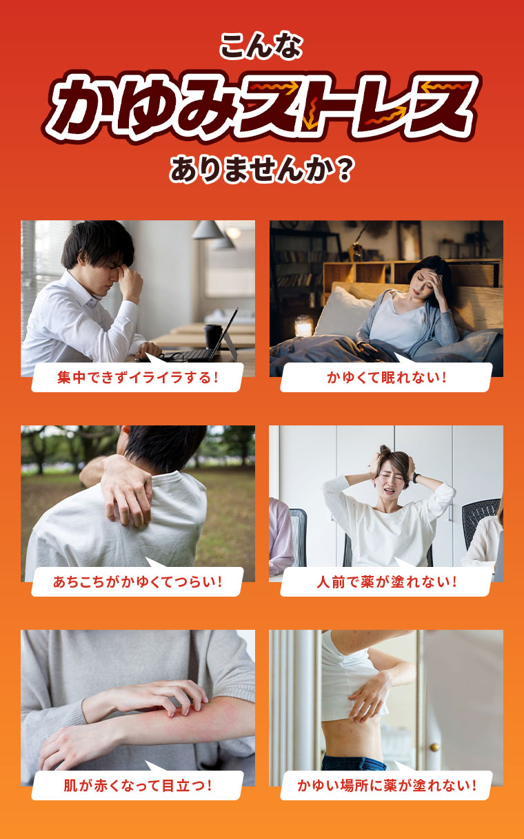 こんなかゆみストレスありませんか？集中できずイライラする！かゆくて眠れない！あちこちがかゆくてつらい！人前で薬が塗れない！肌が赤くなって目立つ！かゆい場所に薬が塗れない！