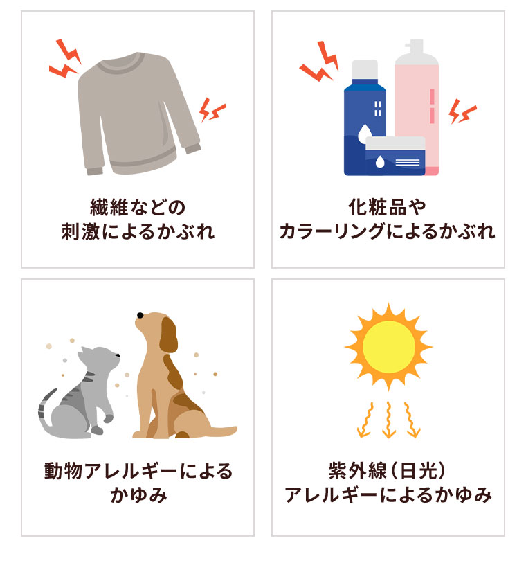 繊維などの刺激によるかぶれ。化粧品やカラーリングによるかぶれ。動物アレルギーによるかゆみ。紫外線(日光)アレルギーによるかゆみ。