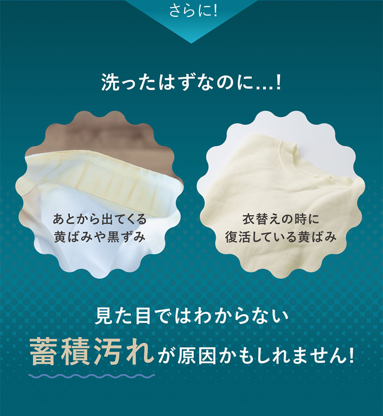 さらに!洗ったはずなのに...!あとから出てくる黄ばみや黒ずみ。衣替えの時に復活している黄ばみ.見た目ではわからない蓄積汚れが原因かもしれません!