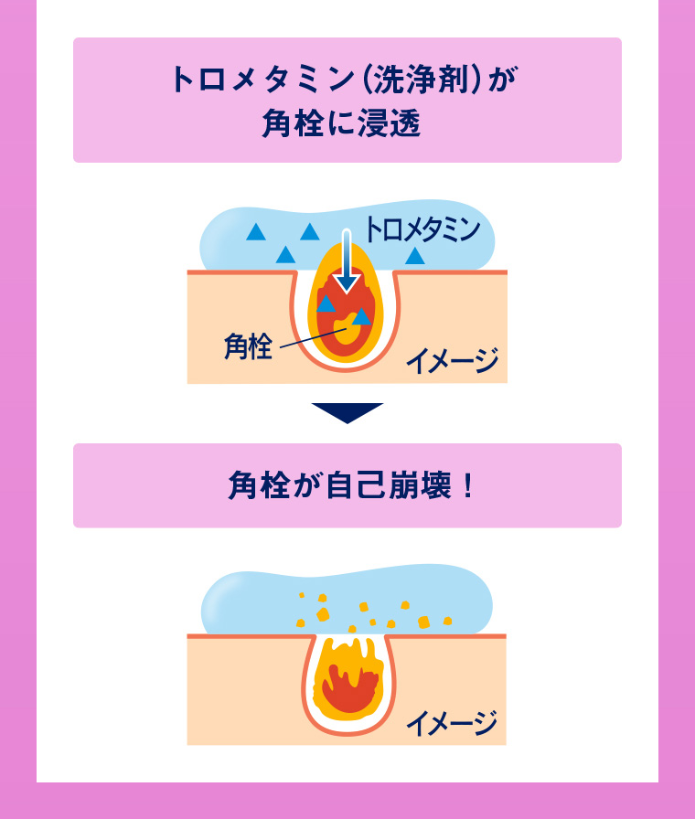 トロメタミン（洗浄剤）が角栓に浸透 → 角栓が自己崩壊！