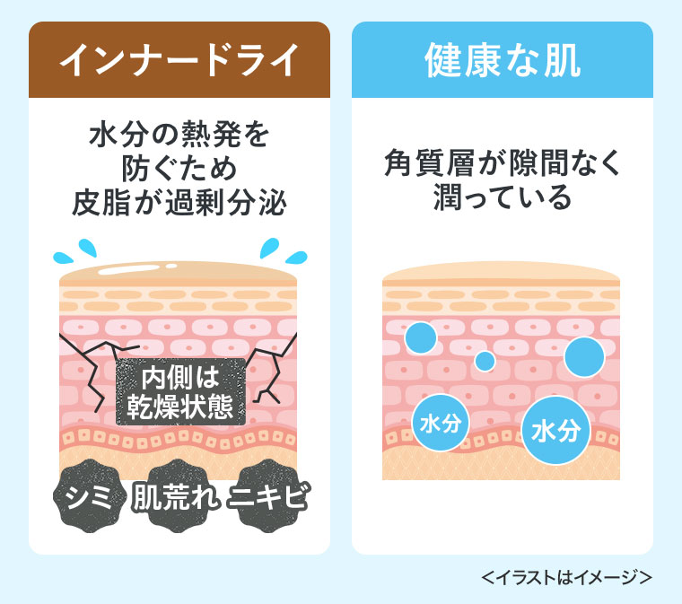 インナードライ。水分の熱発を防ぐため皮脂が過剰分泌。健康な肌。角質層が隙間なく潤っている。イメージ（本画像をご確認ください）。