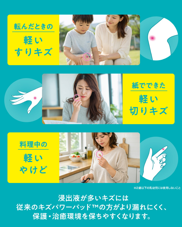 軽いすりキズ、軽い切りキズ、軽いやけどに