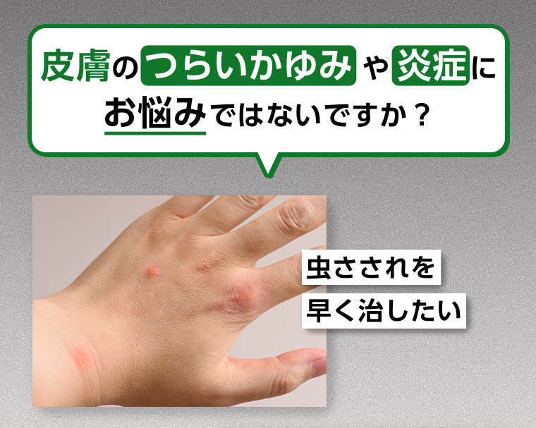 皮膚のつらいかゆみや炎症にお悩みではないですか？