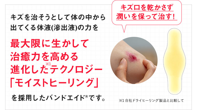 キズを治そうとして体の中から出てくる体液(滲出液)の力を最大限に生かして治癒力を高める進化したテクノロジー「モイストヒーリング」を採用したバンドエイドです。