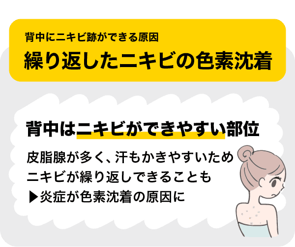背中ニキビに◎集客効果UP 【業務】PEKORA バブリナ ムートンホイップスパ PEKORA ムートンホイップスパ 初回導入セットB【対面研修含む】の卸