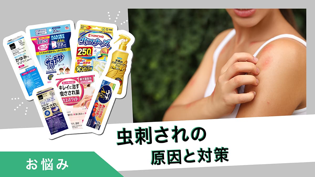 虫刺されの原因は何の虫？刺された時の対策を紹介