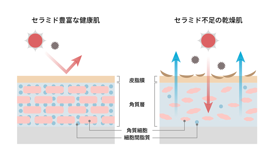 セラミド豊富な健康肌とセラミド不足の乾燥肌の比較