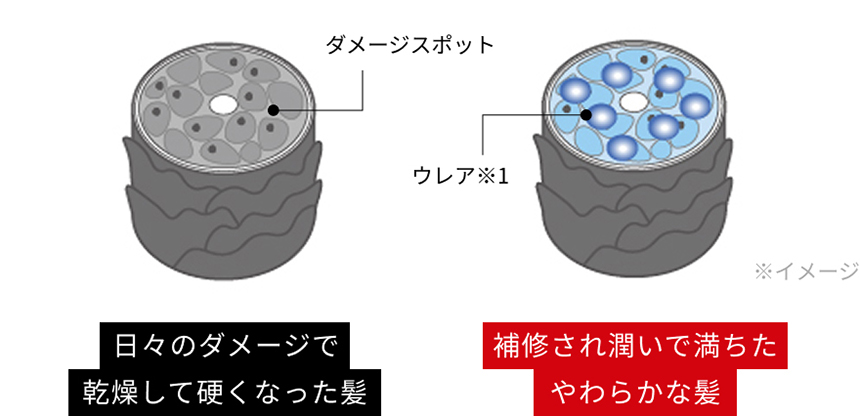 ゴワつきをケアする「ウレア」