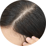 グリチルリチン酸ジカリウム イソプロピルメチルフェノール