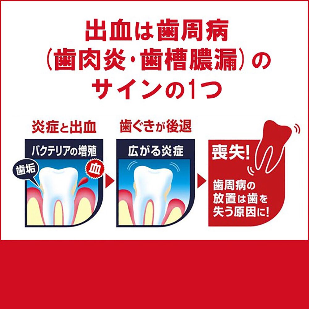 カムテクト　歯ぐきケア １１５ｇ ヘイリオンジャパン (医薬部外品)