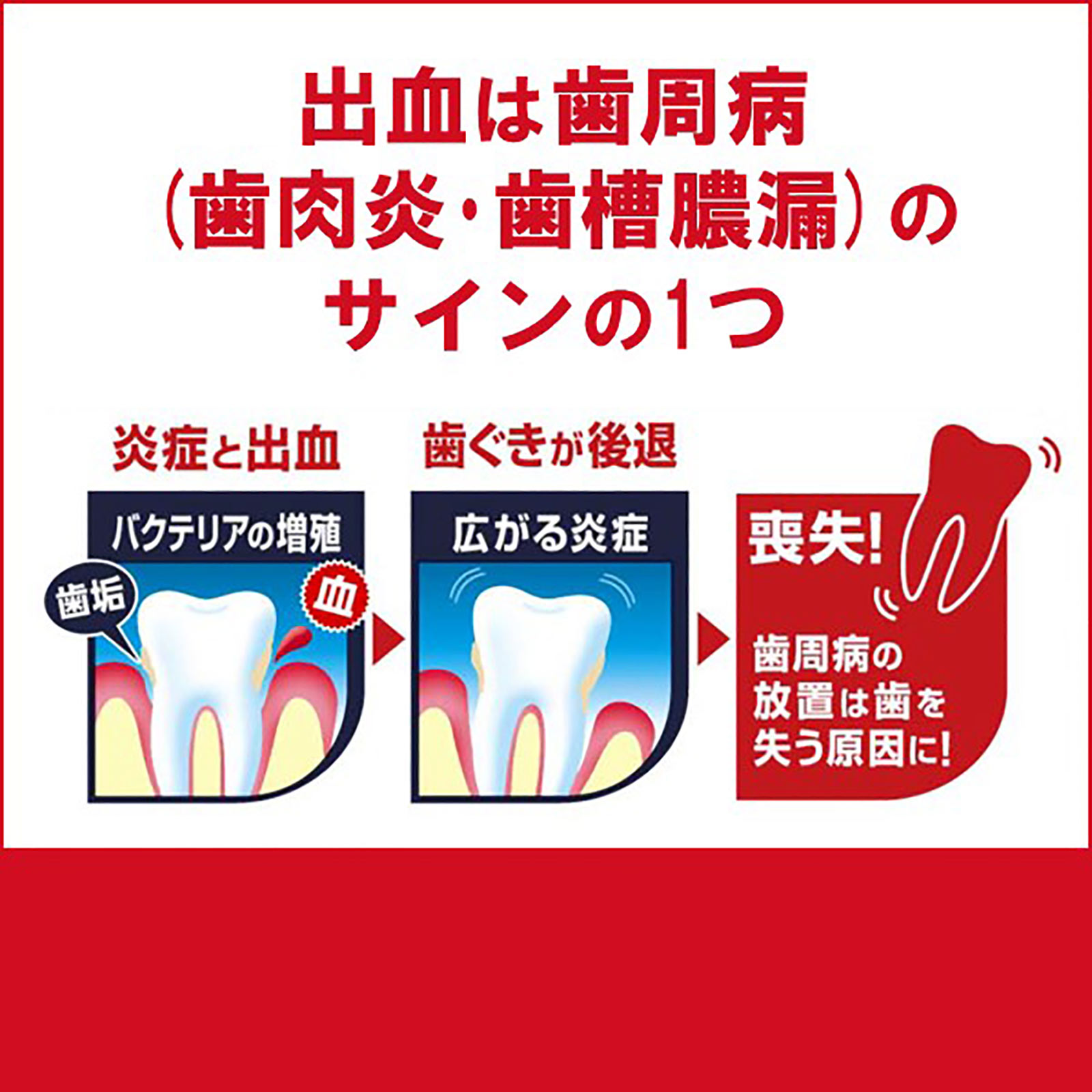 カムテクト　歯ぐきケア １１５ｇ ヘイリオンジャパン (医薬部外品)