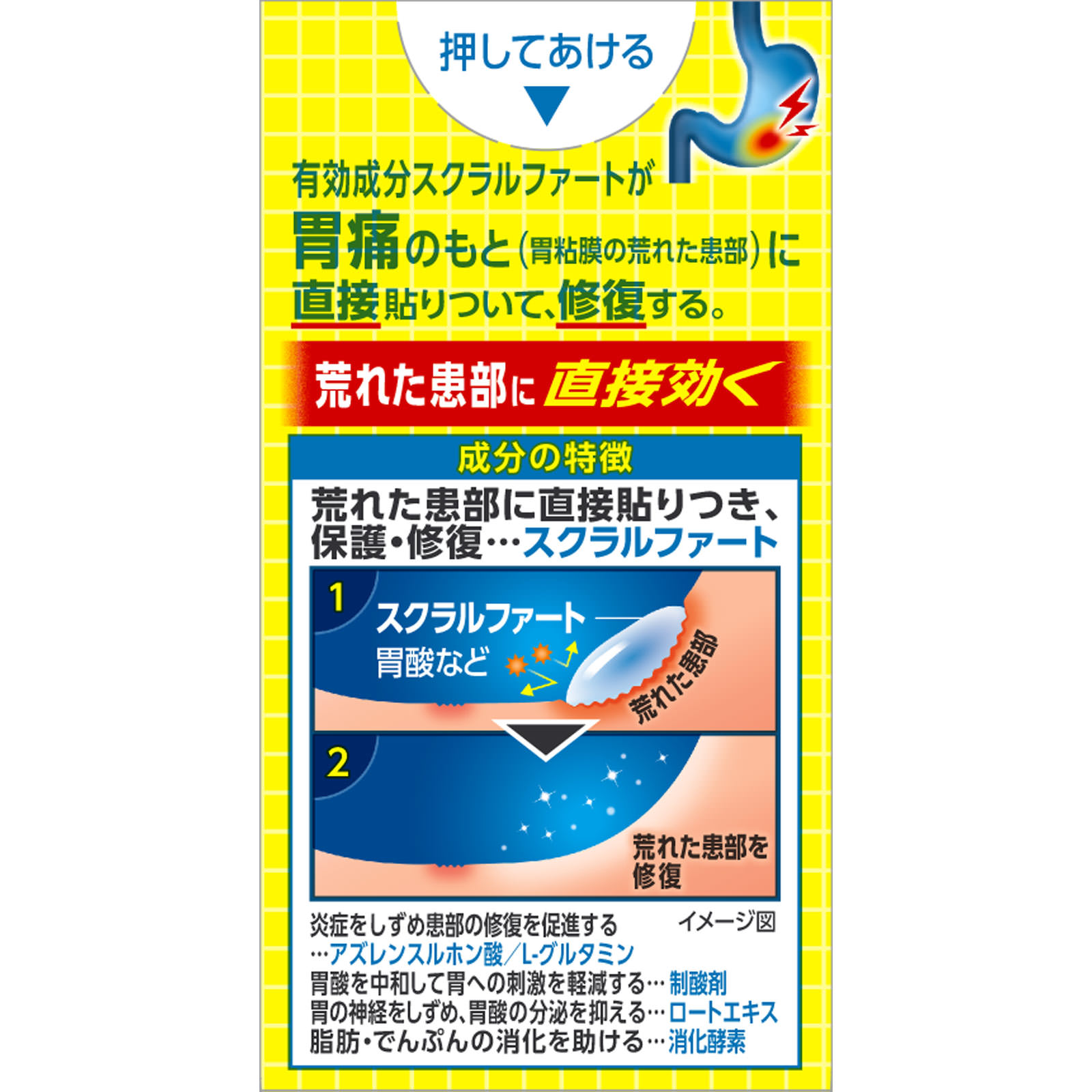 スクラート胃腸薬（錠剤） ３６錠 ライオン 【第2類医薬品】