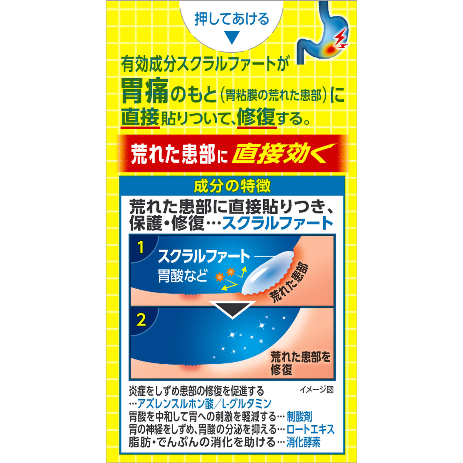 スクラート胃腸薬（錠剤） １０２錠 ライオン 【第2類医薬品】