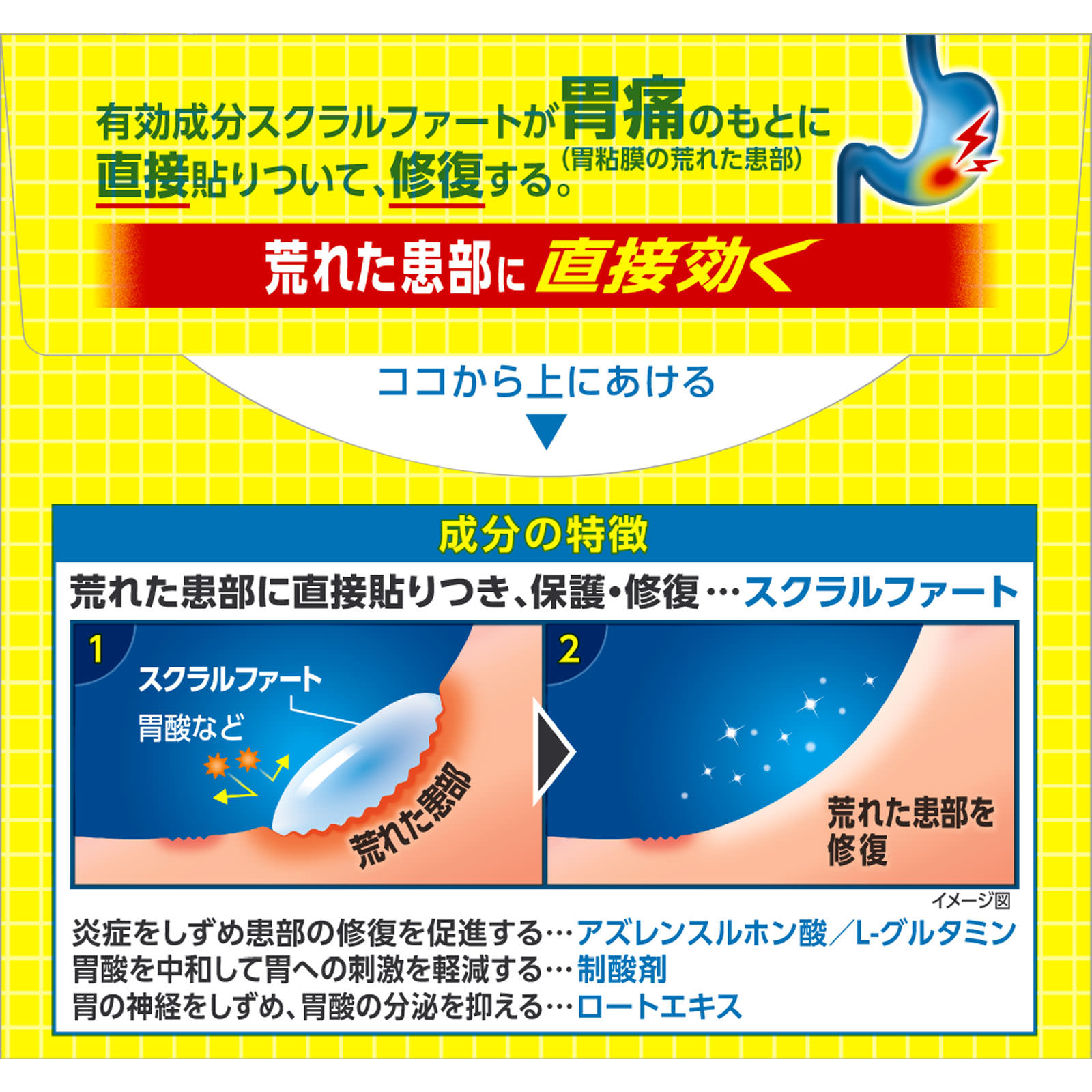 スクラート胃腸薬（顆粒） ３４包 ライオン 【第2類医薬品】