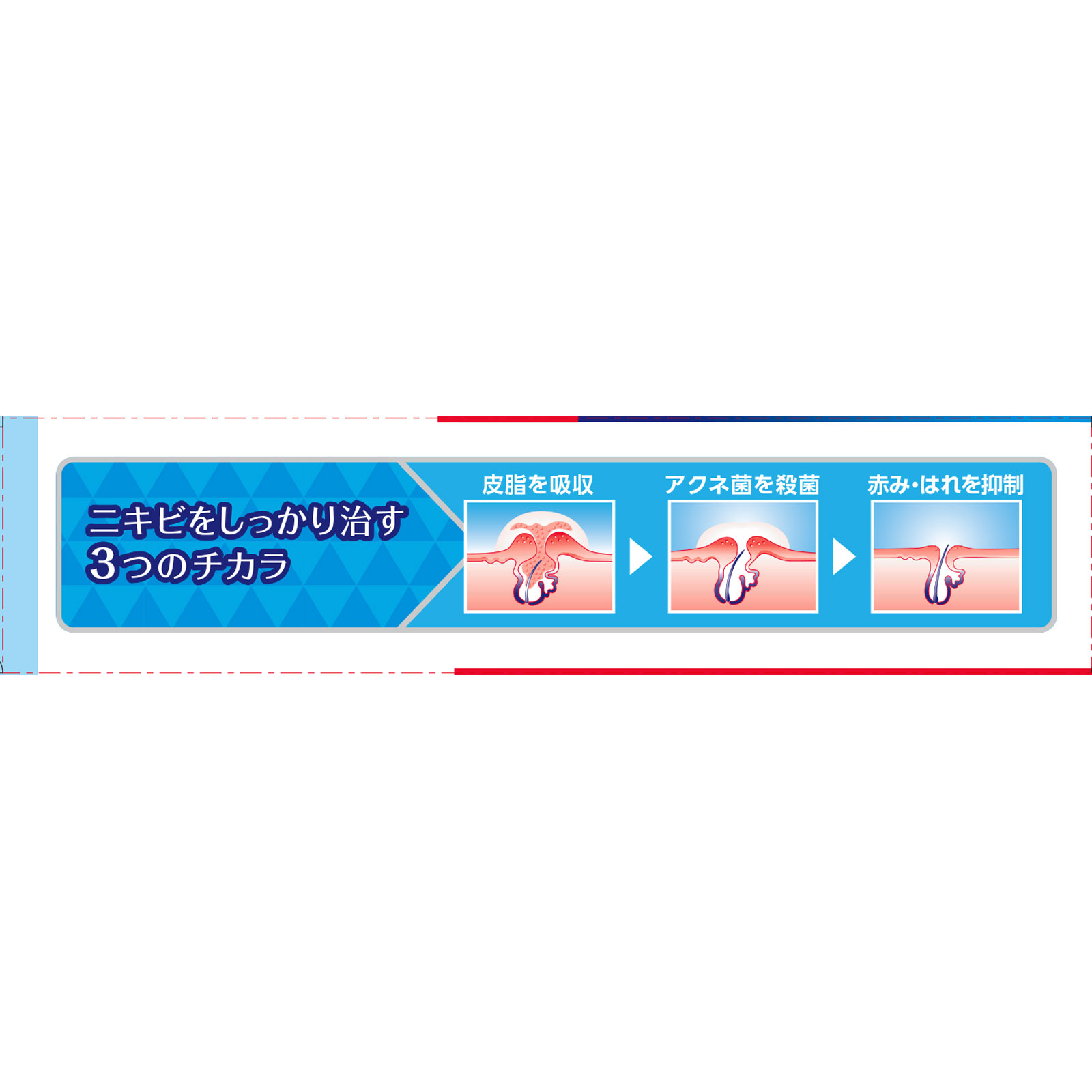 クレアラシル ニキビ治療薬クリーム 白色タイプ ２８ｇ レキットベンキーザー・ジャパン 【第2類医薬品】