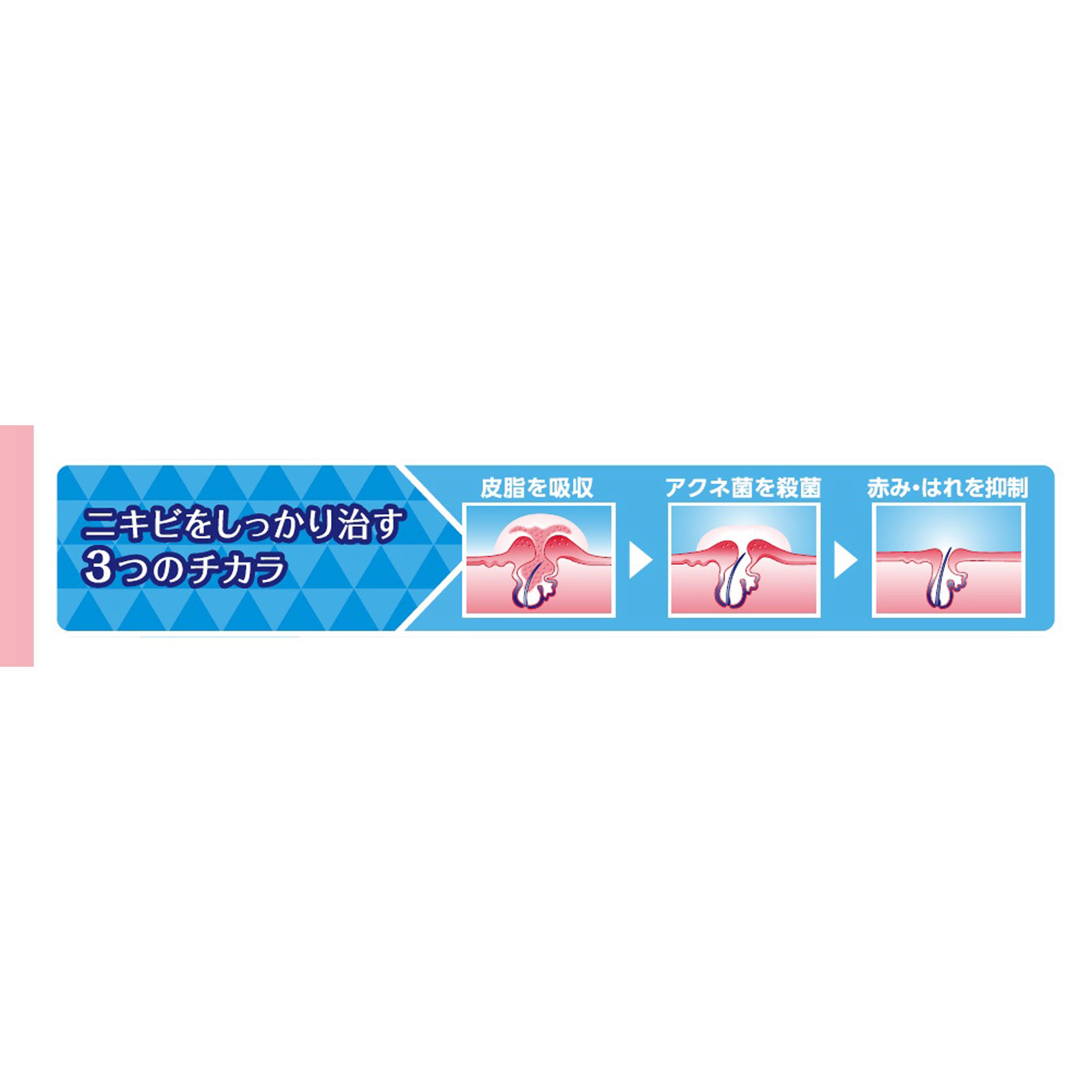 クレアラシル ニキビ治療薬クリーム 肌色タイプ １８ｇ レキットベンキーザー・ジャパン 【第2類医薬品】