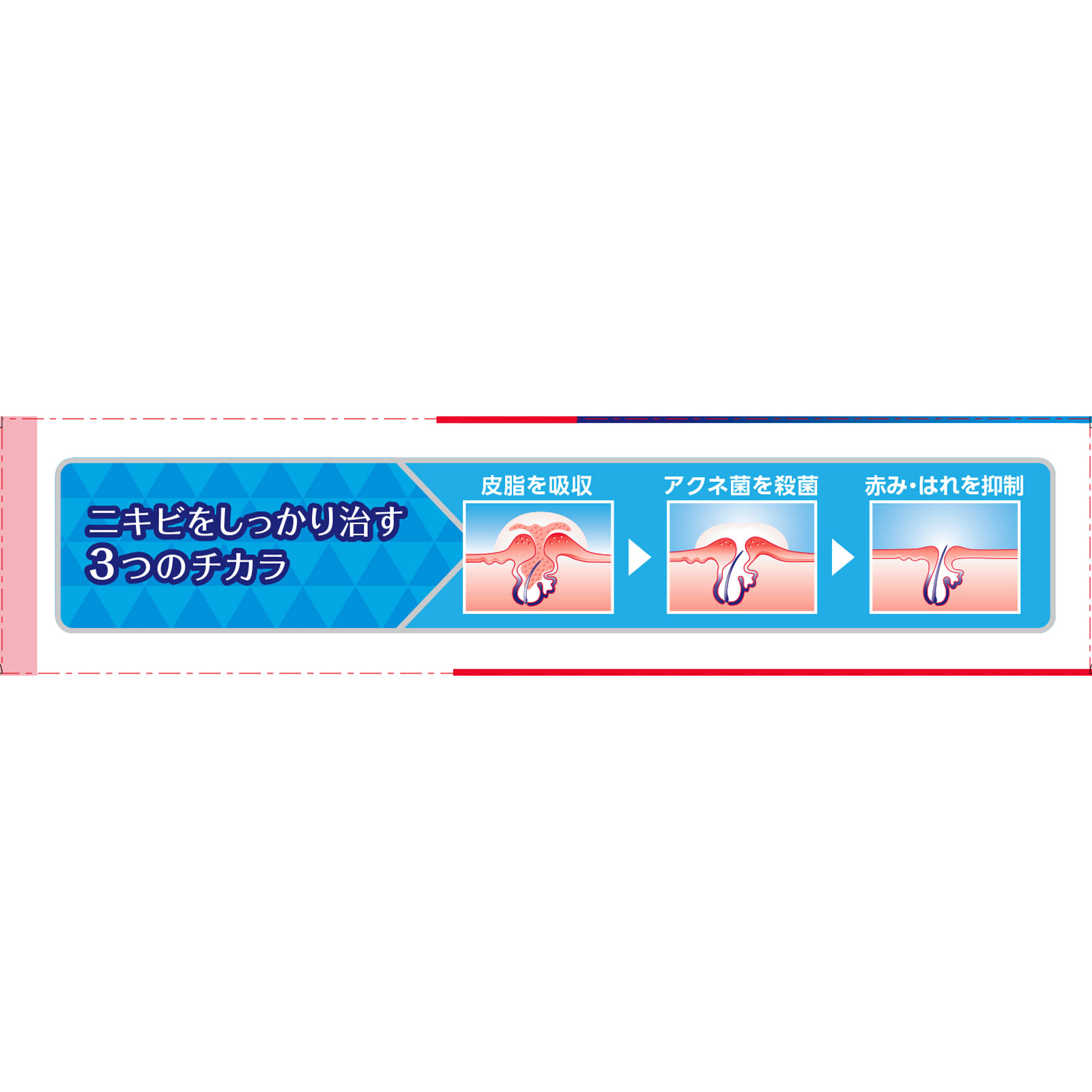 クレアラシル ニキビ治療薬クリーム 肌色タイプ ２８ｇ レキットベンキーザー・ジャパン 【第2類医薬品】