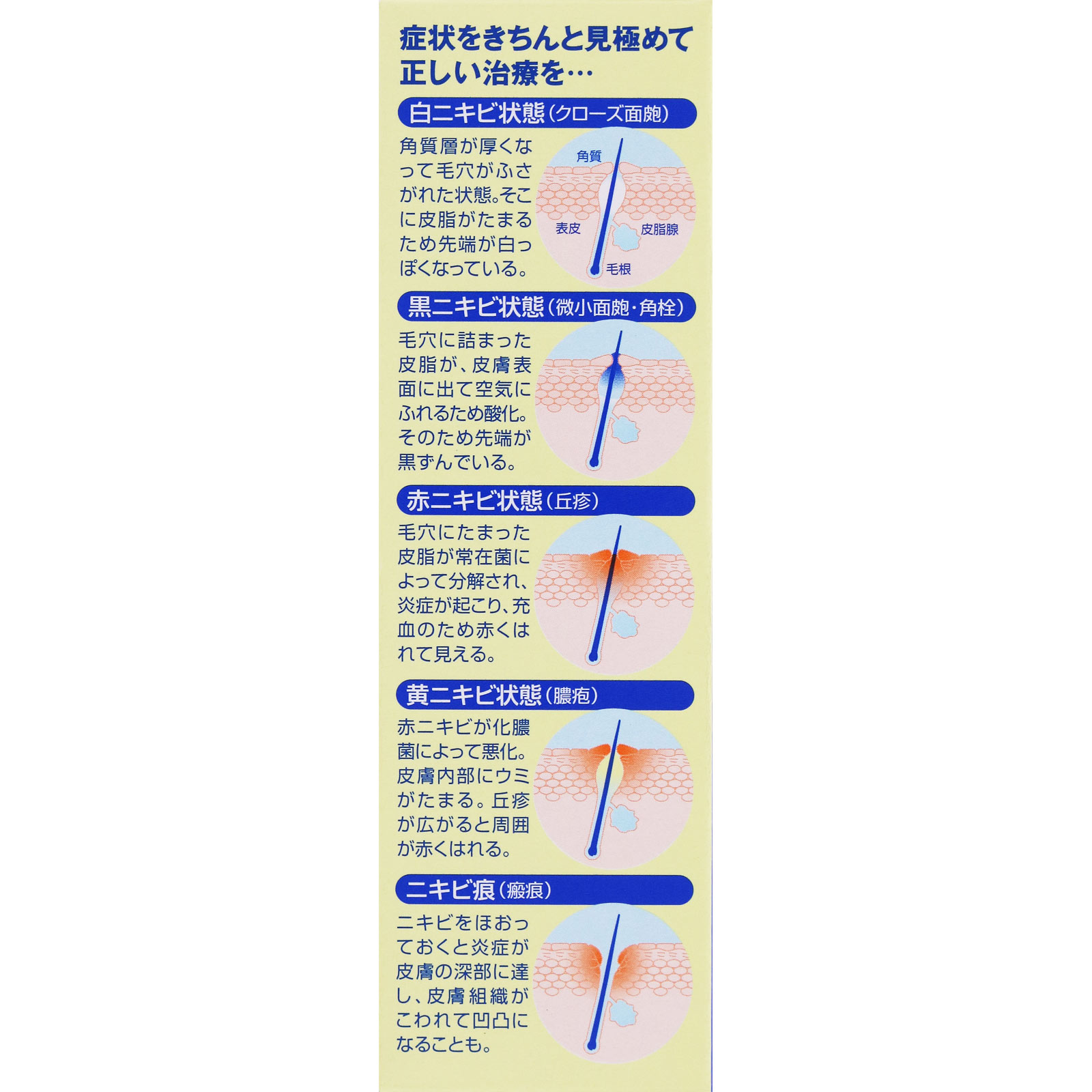 メンターム アクネローション １１０ｍｌ 近江兄弟社 【第2類医薬品】