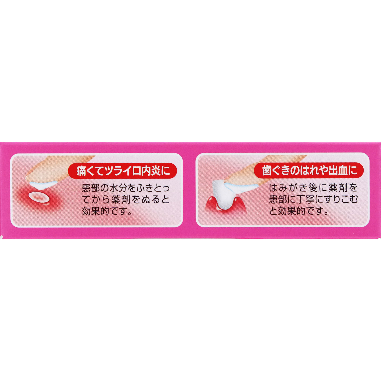 新デスパコーワ ７ｇ 興和 【第3類医薬品】
