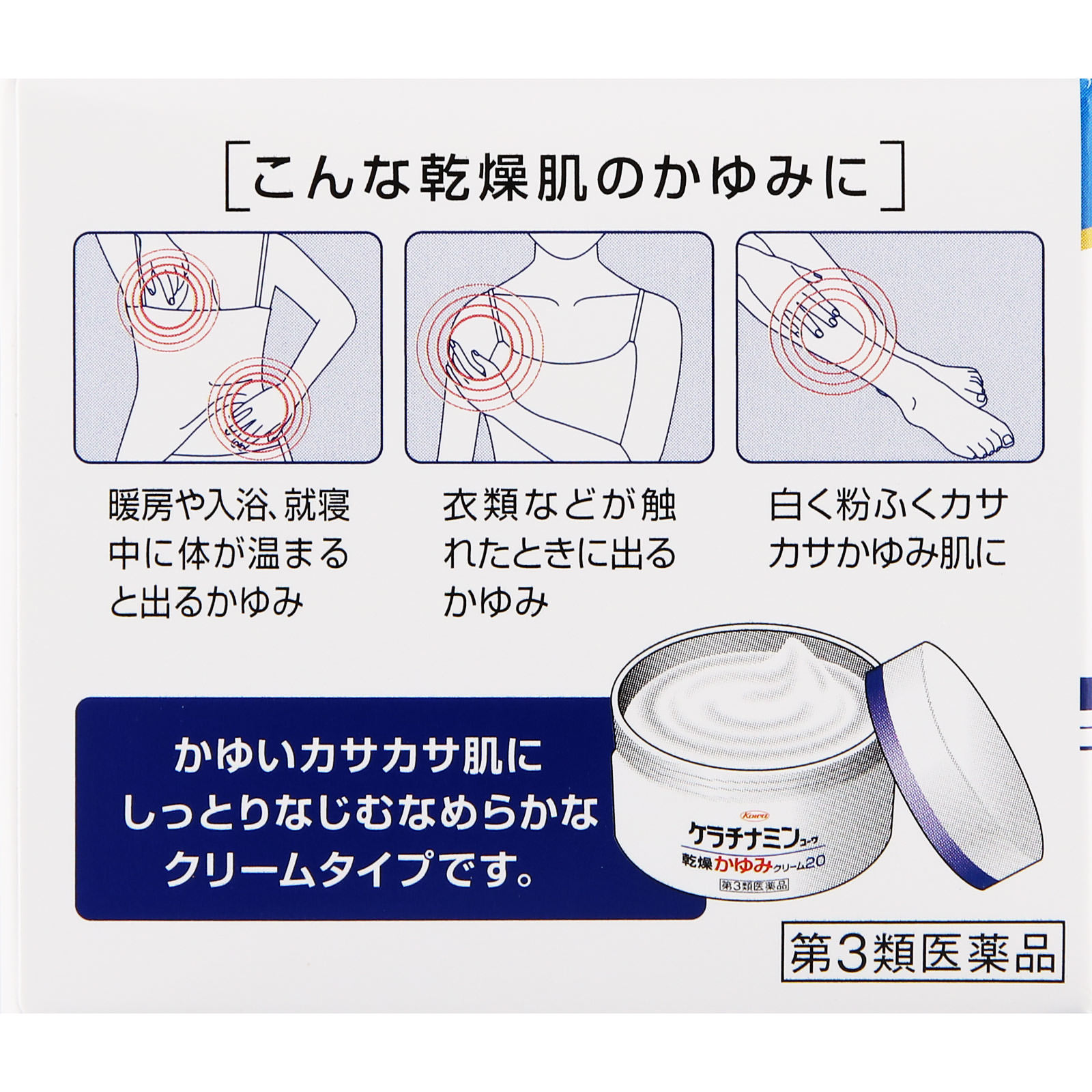 ケラチナミンコーワ乾燥かゆみクリーム２０ ８０ｇ 興和 【第3類医薬品】