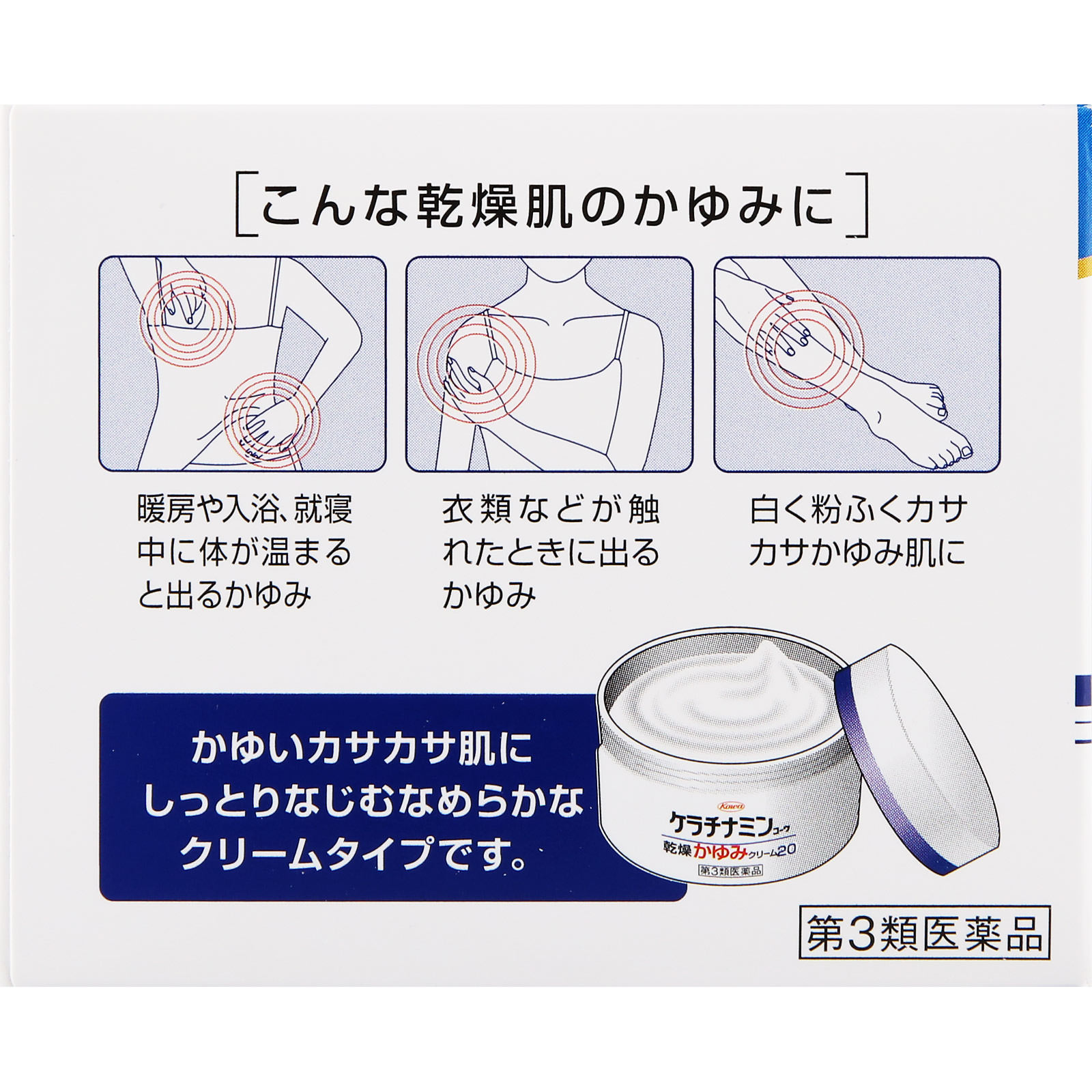 ケラチナミンコーワ乾燥かゆみクリーム２０ １４０ｇ 興和 【第3類医薬品】