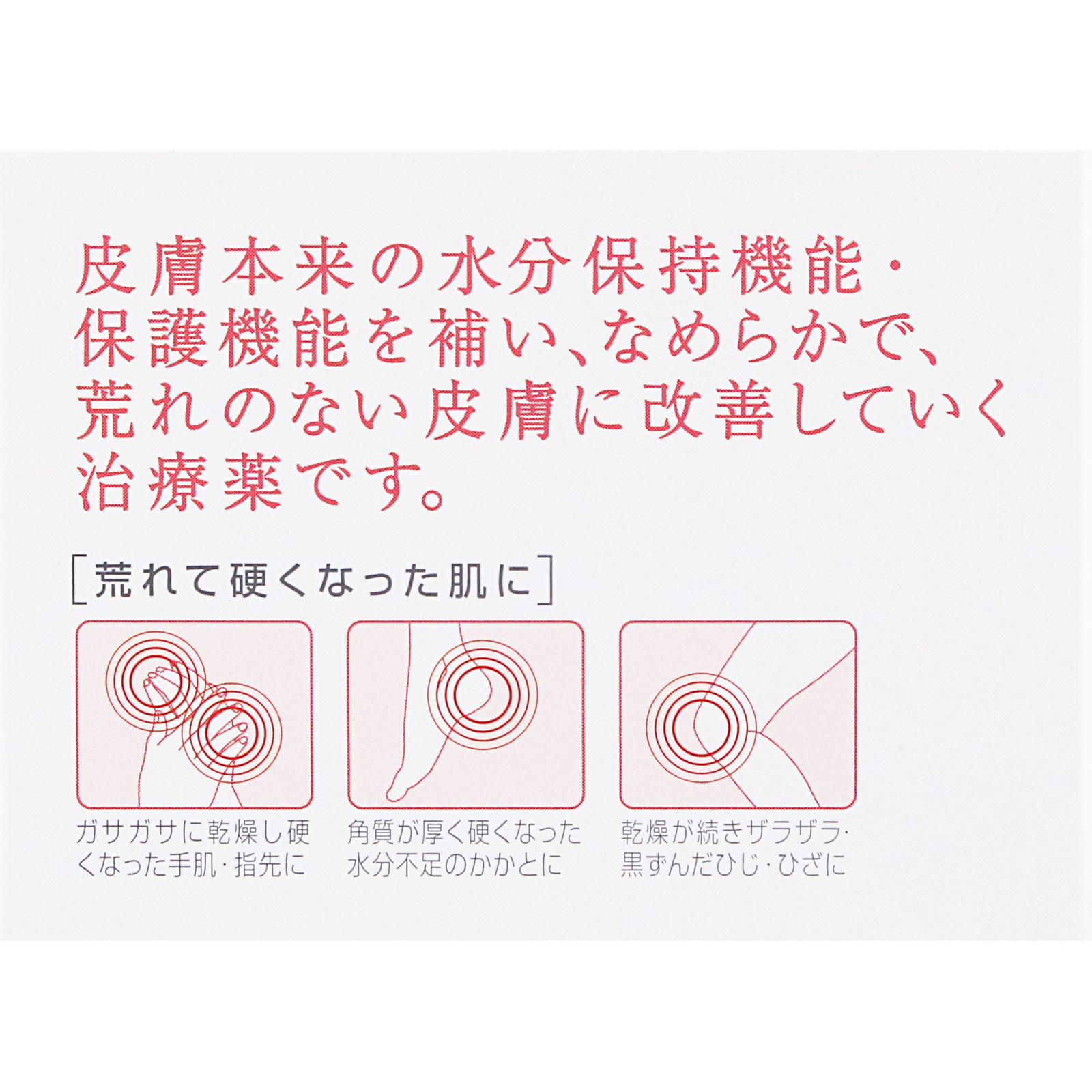 ケラチナミンコーワWクリーム 75g 興和 【第3類医薬品】