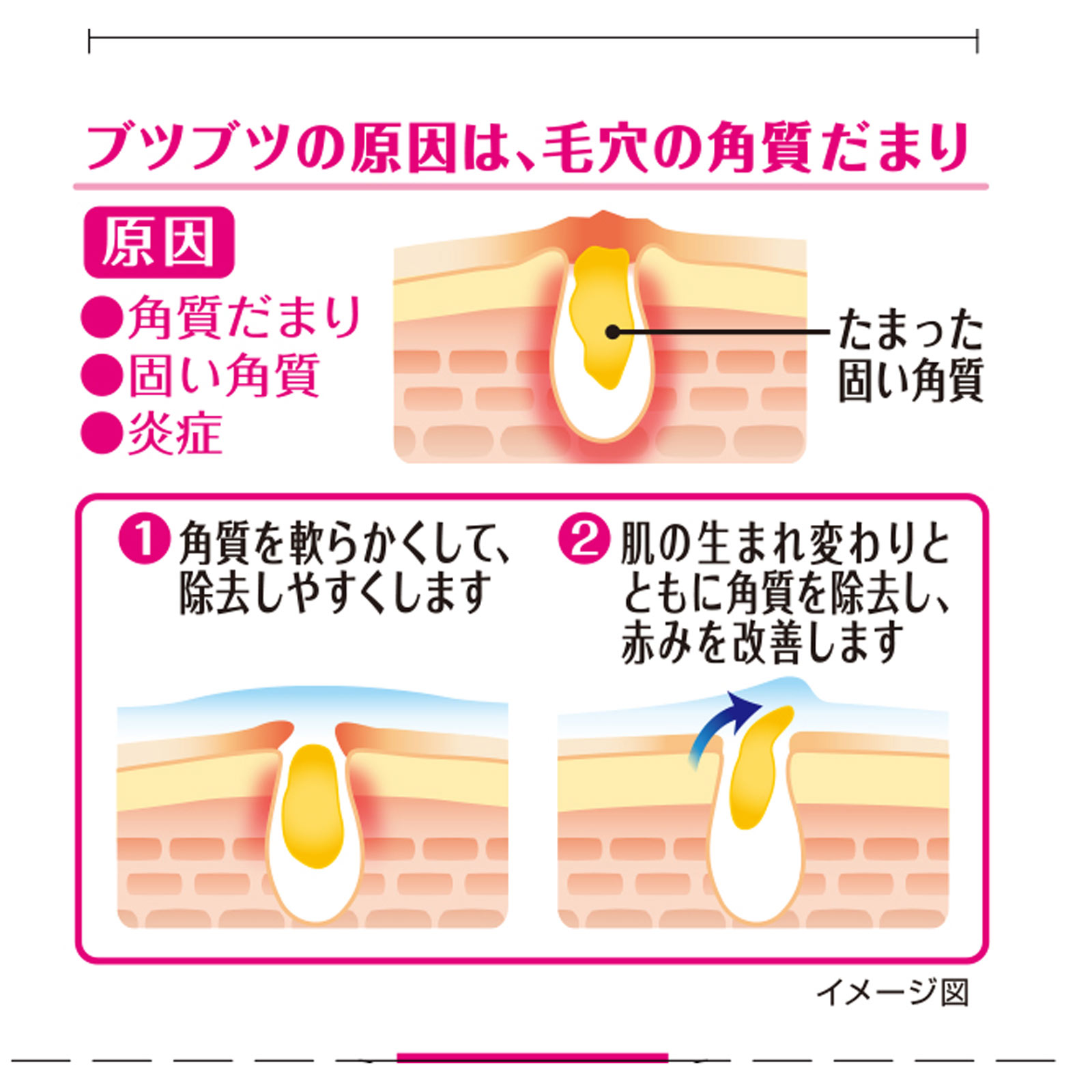 ニノキュア ３０ｇ 小林製薬 【第3類医薬品】