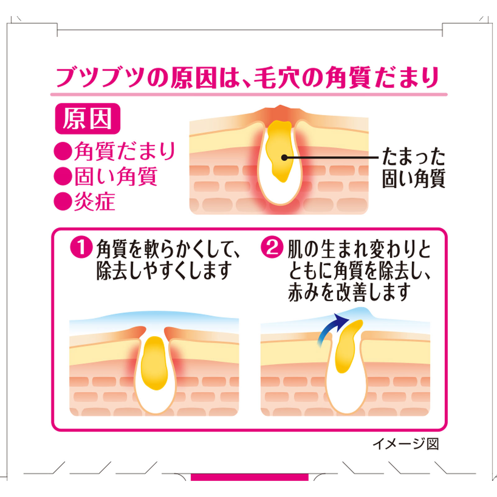 ニノキュア ３０ｇ 小林製薬 【第3類医薬品】