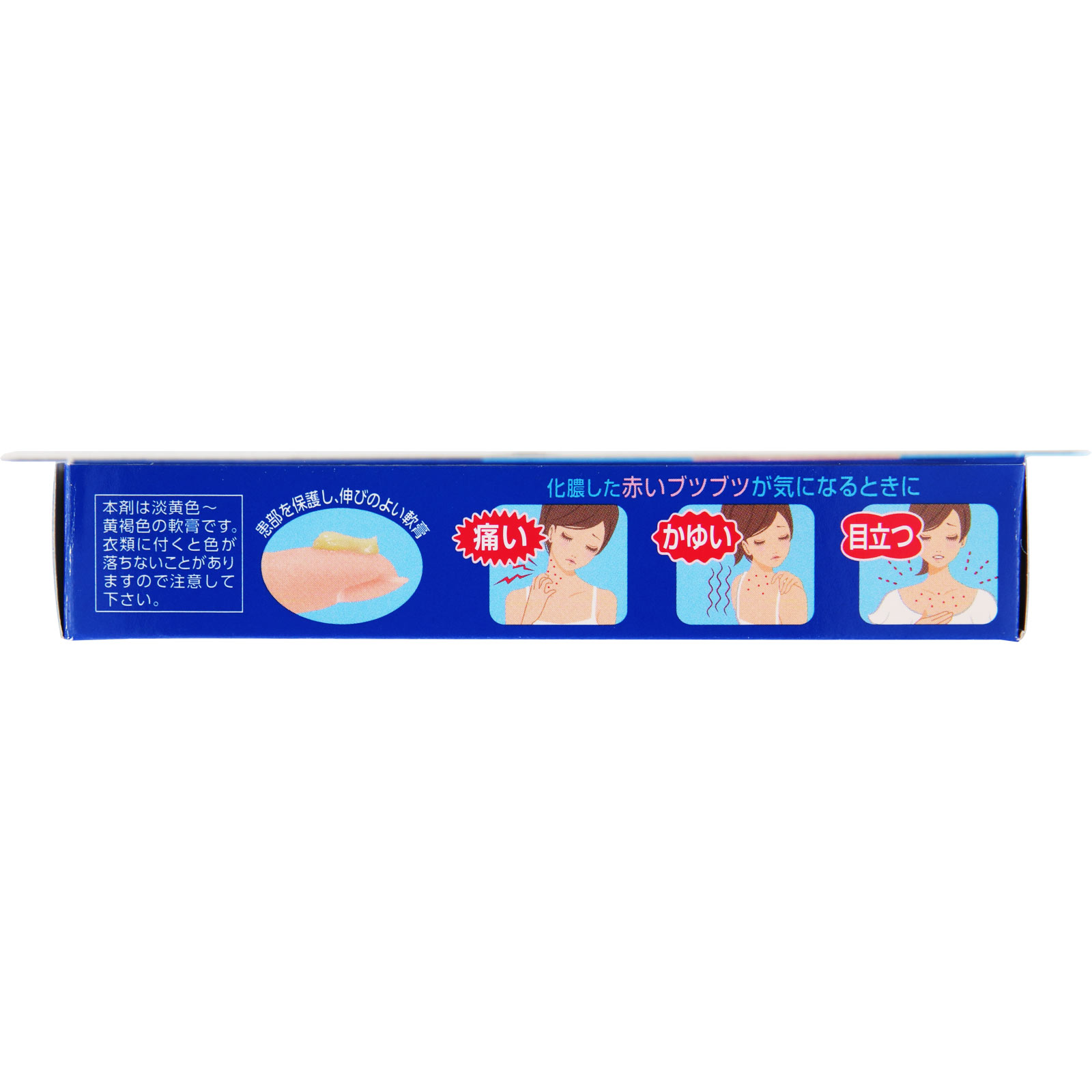 クロマイＮ軟膏 １２ｇ 第一三共ヘルスケア 【第2類医薬品】