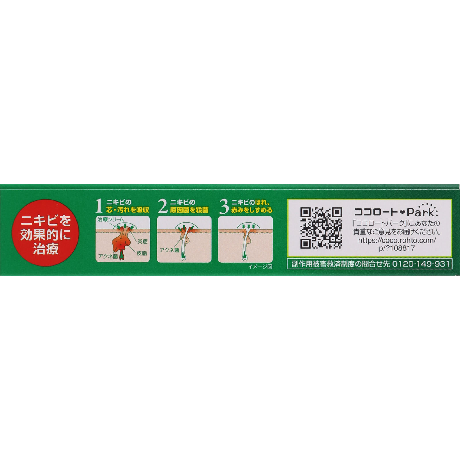 メンソレータム　アクネス　ニキビ治療薬 １８ｇ ロート製薬 【第2類医薬品】