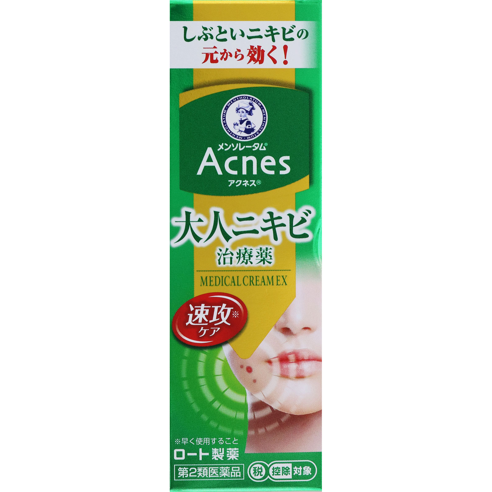 メンソレータム　アクネス２５　メディカルクリームＥＸａ １６ｇ ロート製薬 【第2類医薬品】