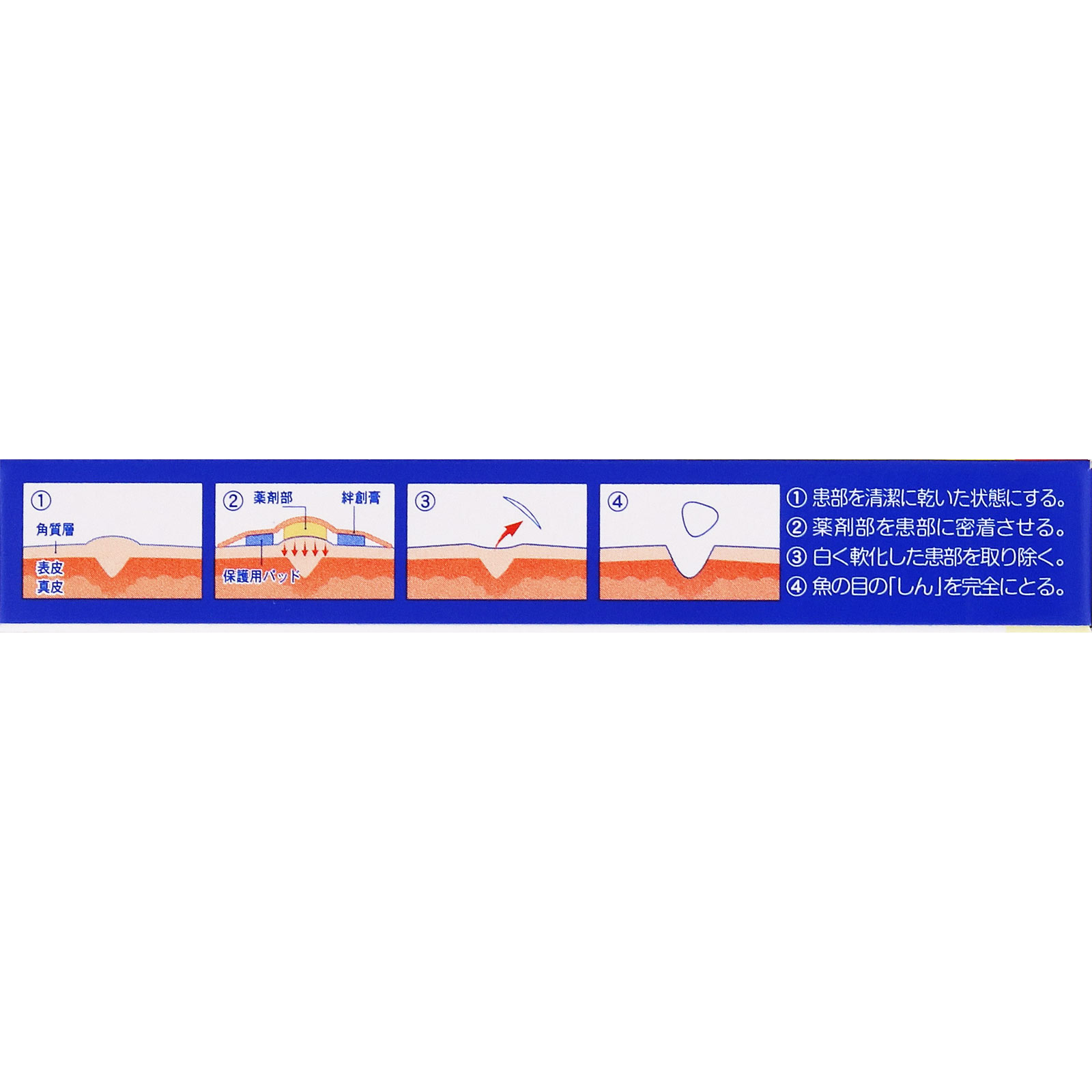 MK ウオノメコロリ絆創膏 足裏用 ６個 横山製薬 【第2類医薬品】