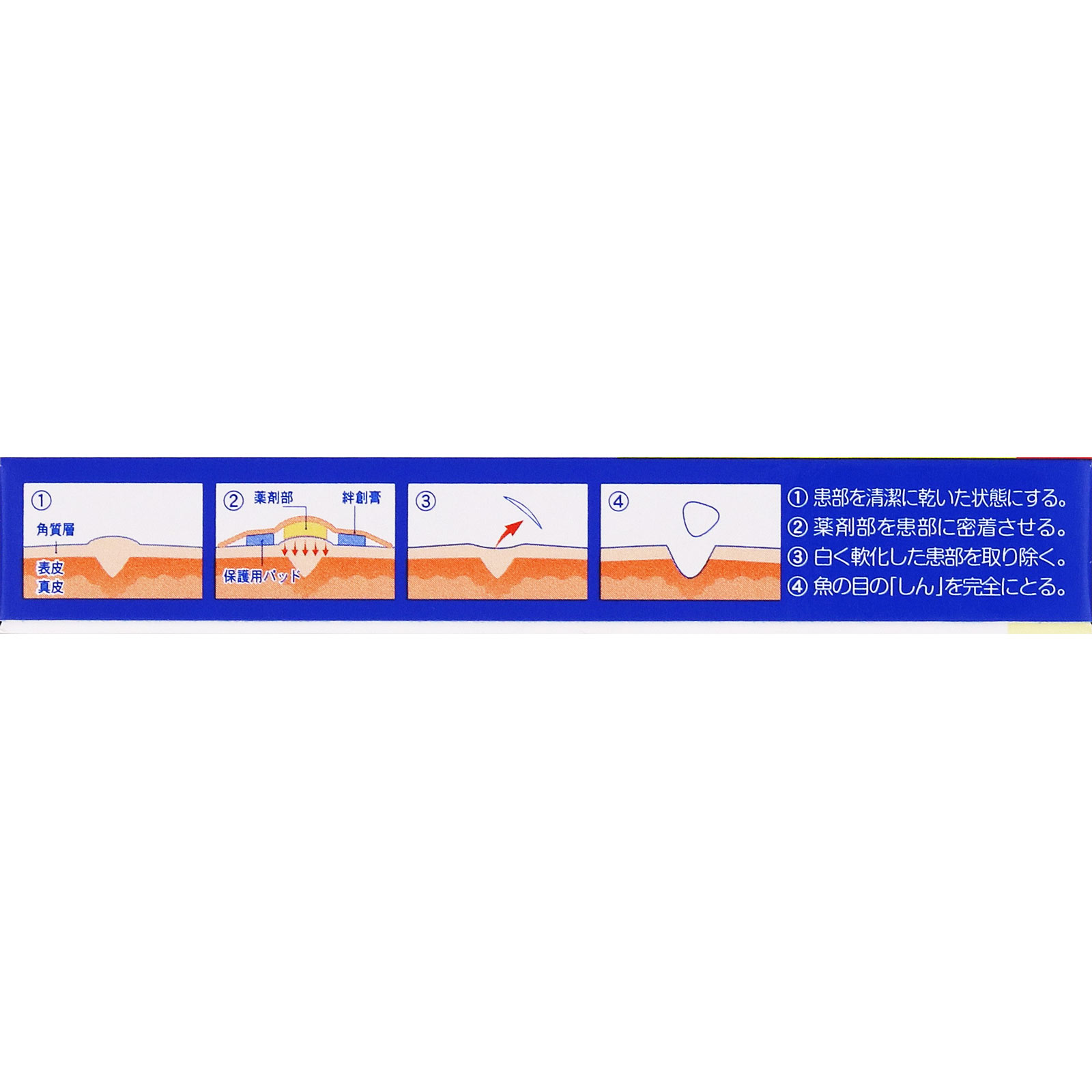 MK ウオノメコロリ絆創膏 足指用 １２個 横山製薬 【第2類医薬品】