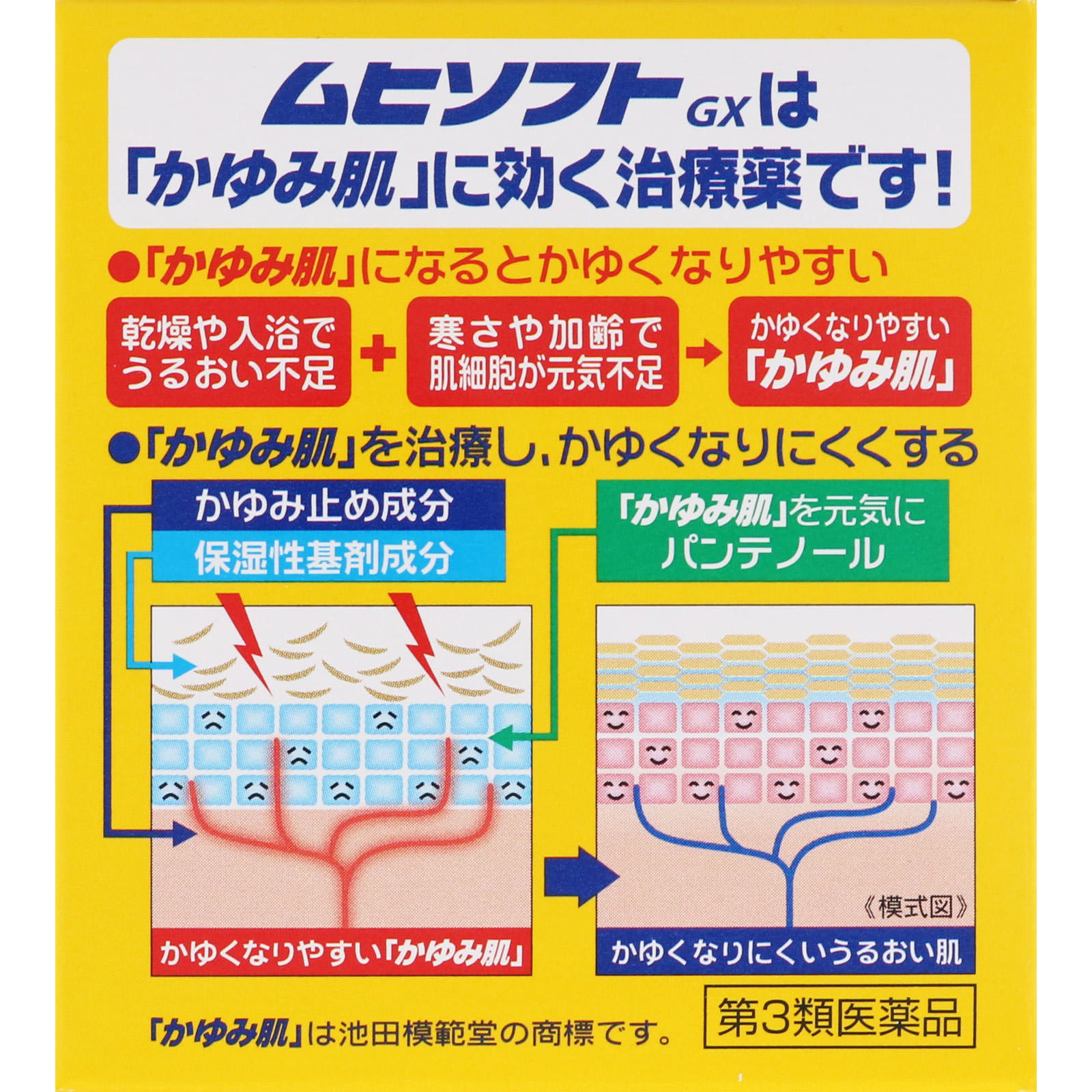 かゆみ肌の治療薬 ムヒソフトGX １００ｇ 池田模範堂 【第3類医薬品】