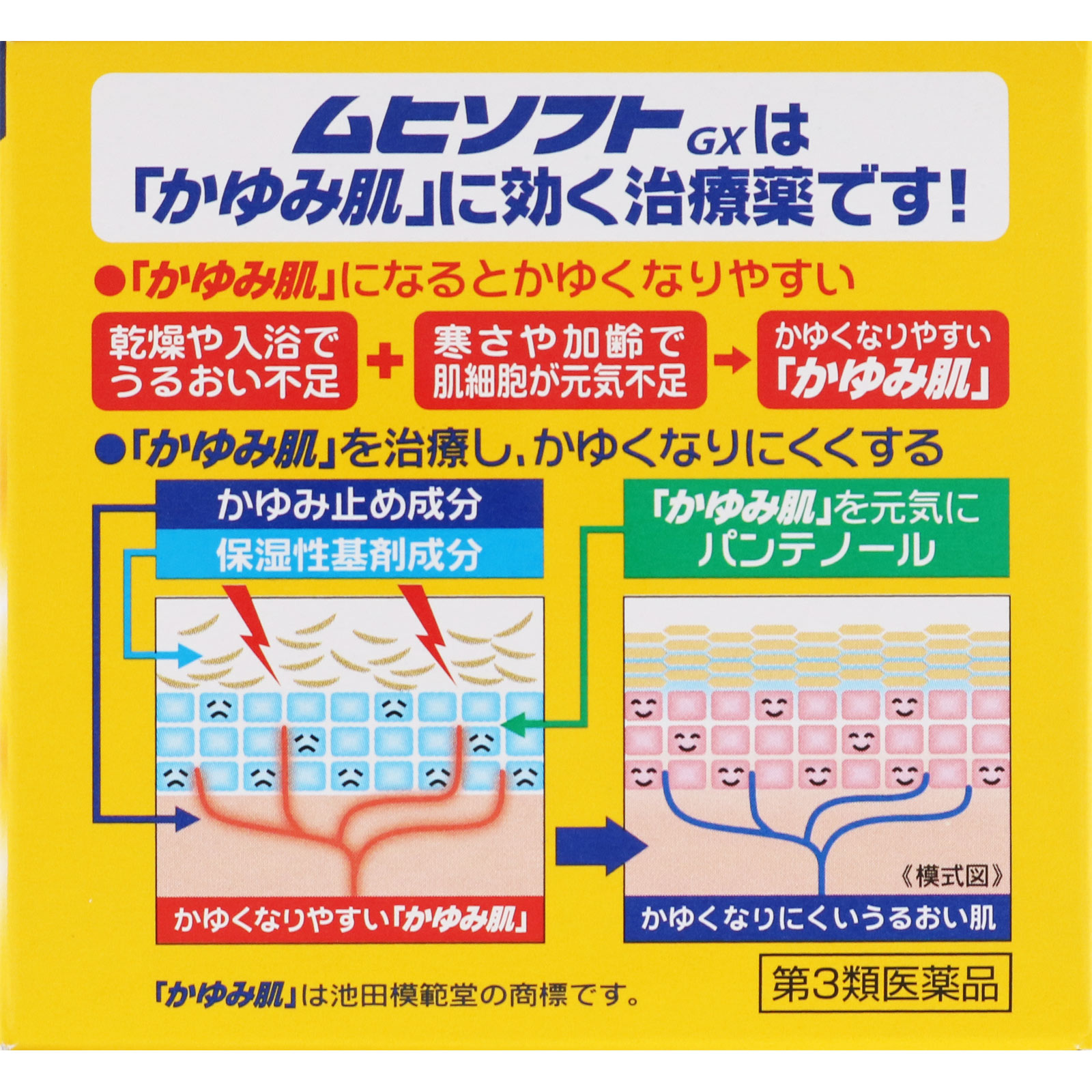 かゆみ肌の治療薬 ムヒソフトGX １５０ｇ 池田模範堂 【第3類医薬品】