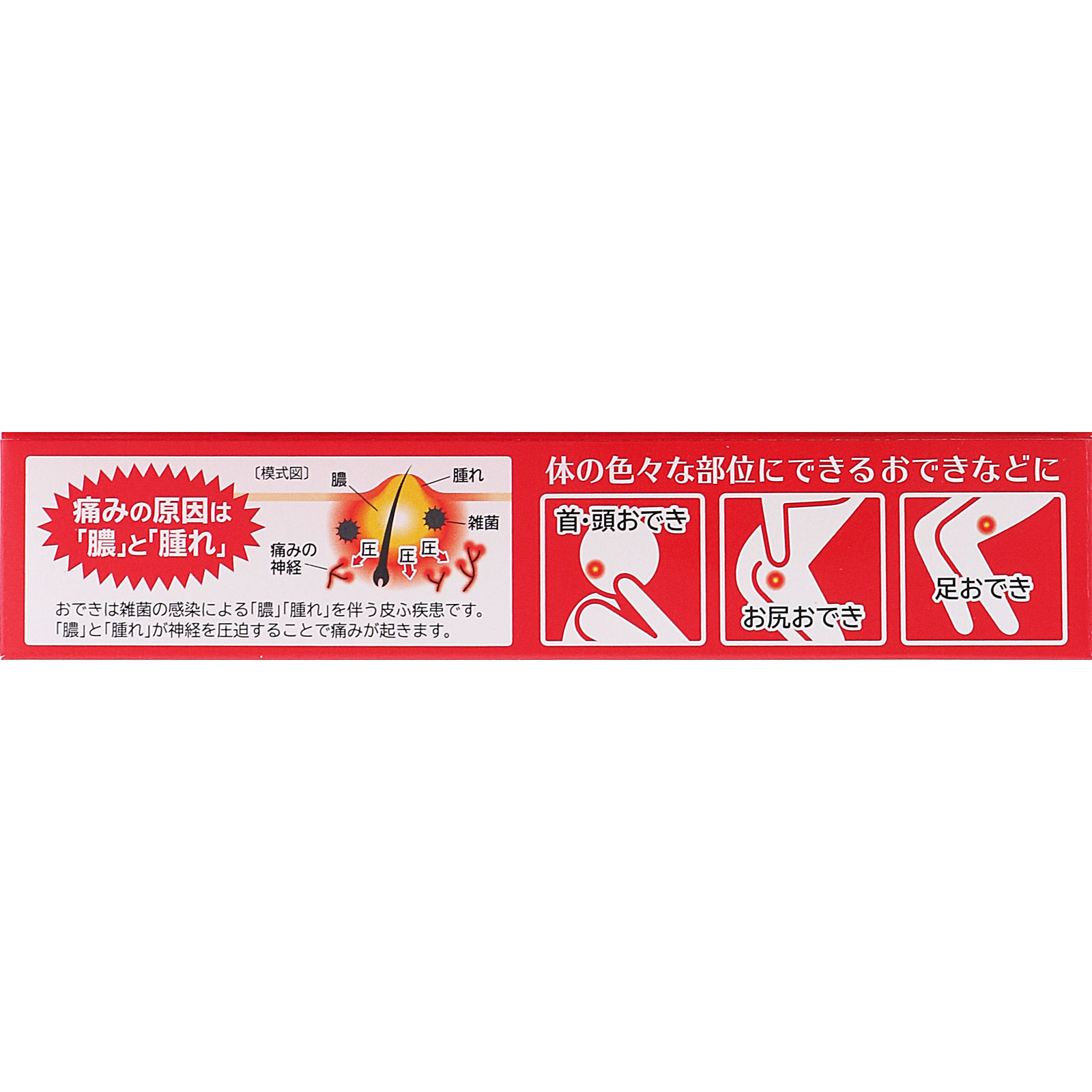 オデキュアＥＸ １２ｇ 池田模範堂 【第2類医薬品】