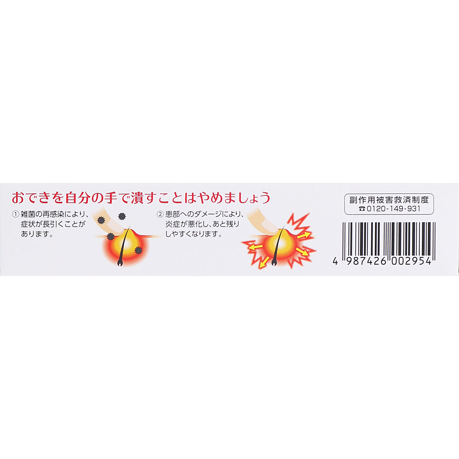 オデキュアＥＸ １２ｇ 池田模範堂 【第2類医薬品】