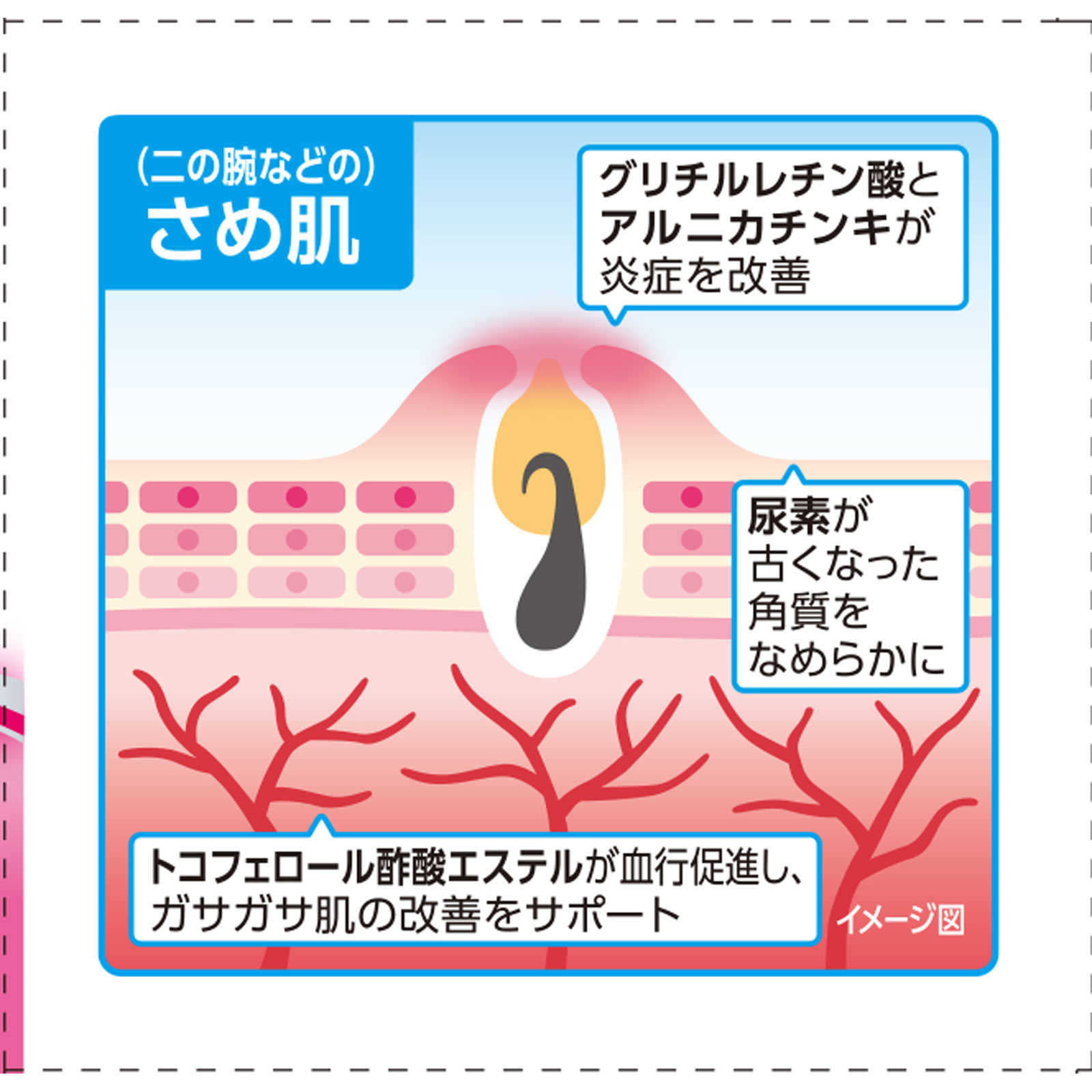 ケラチナミンクロザラエイド ６０ｇ 興和 【第3類医薬品】