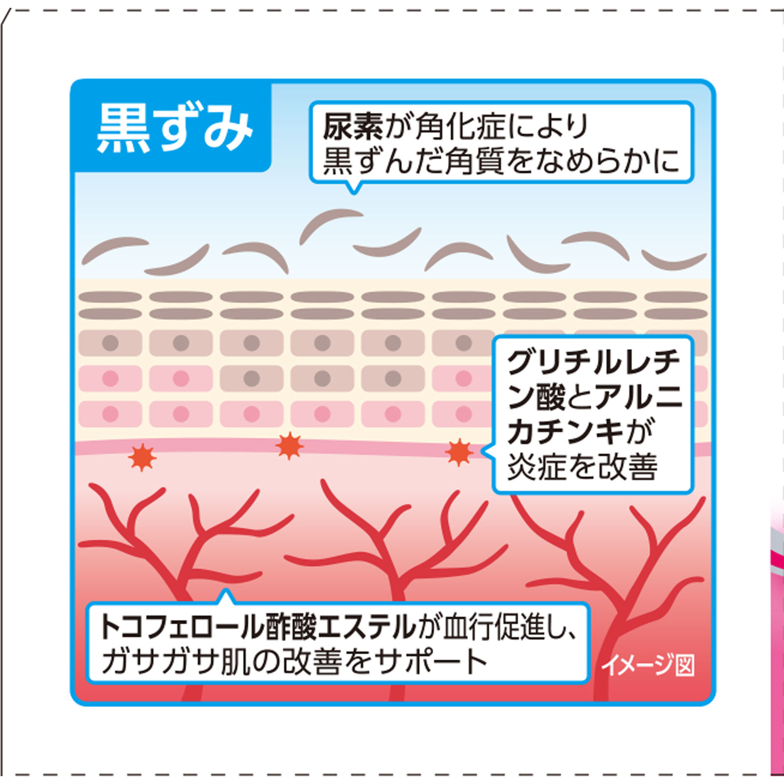 ケラチナミンクロザラエイド ６０ｇ 興和 【第3類医薬品】